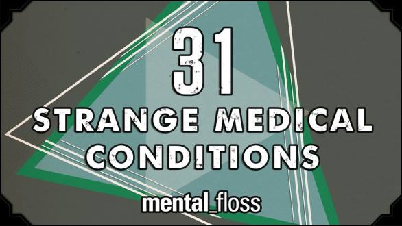 31 Strange Medical Conditions - Summer Bummer Series pt. 1 - mental_floss on YouTube (Ep.13) - YouTube